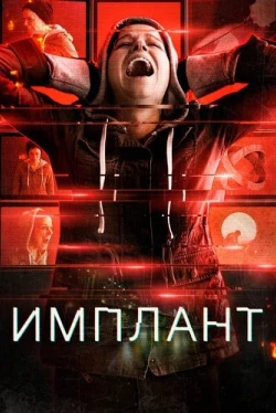 Имплант (2021)